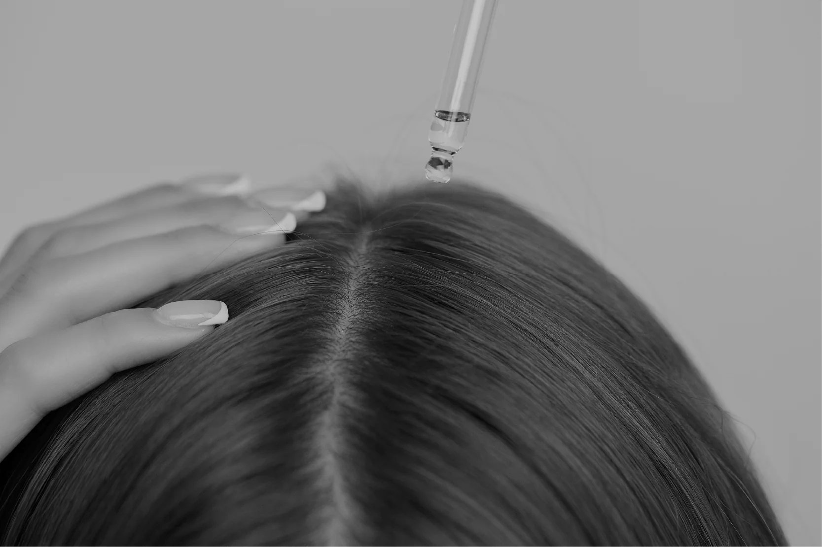 Minoxidil oral vs tópico: ¿cuál te conviene más? - Pharma Grow