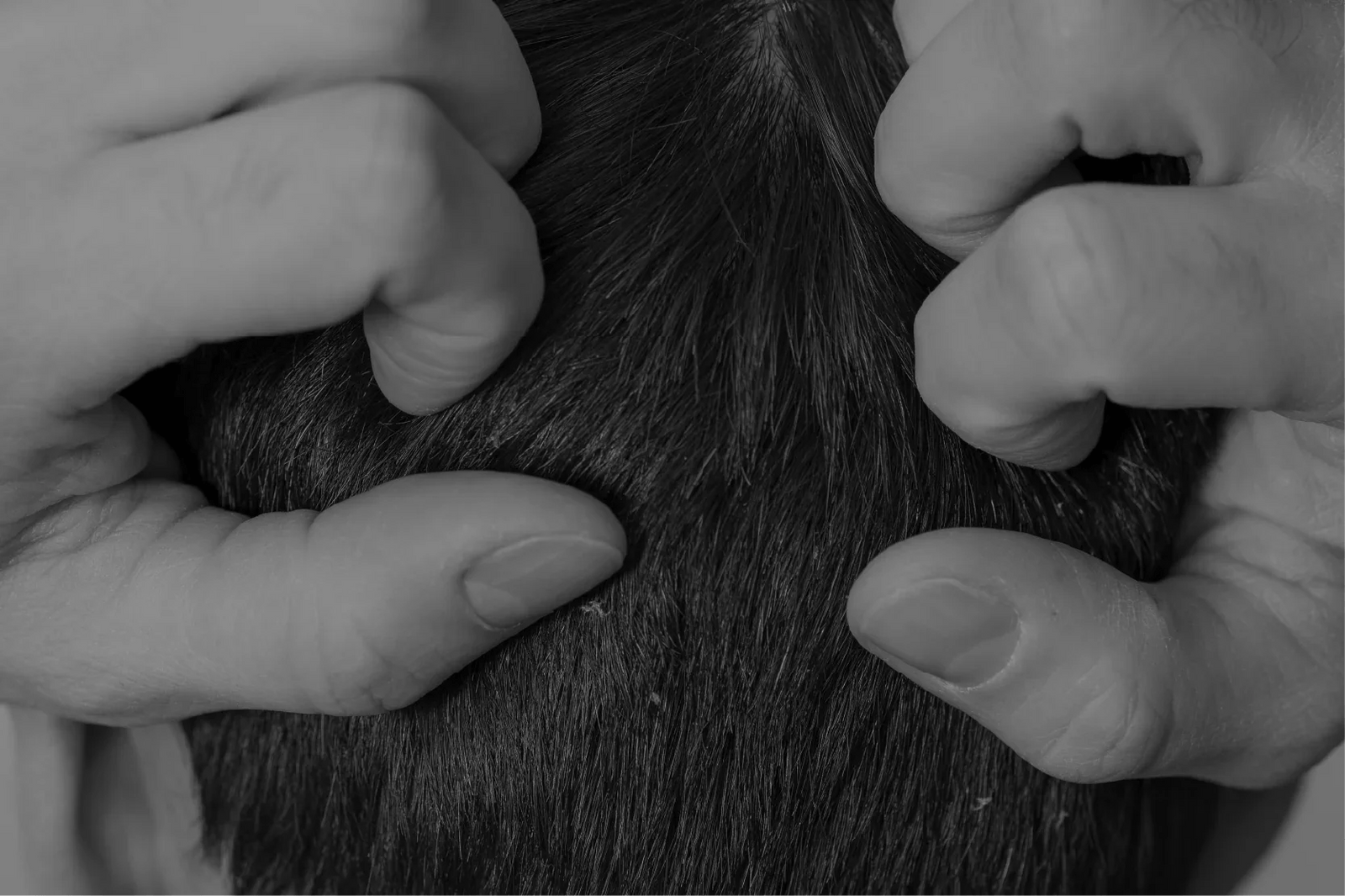 ¿Me voy a quedar calvo como mi papá? - Pharma Grow