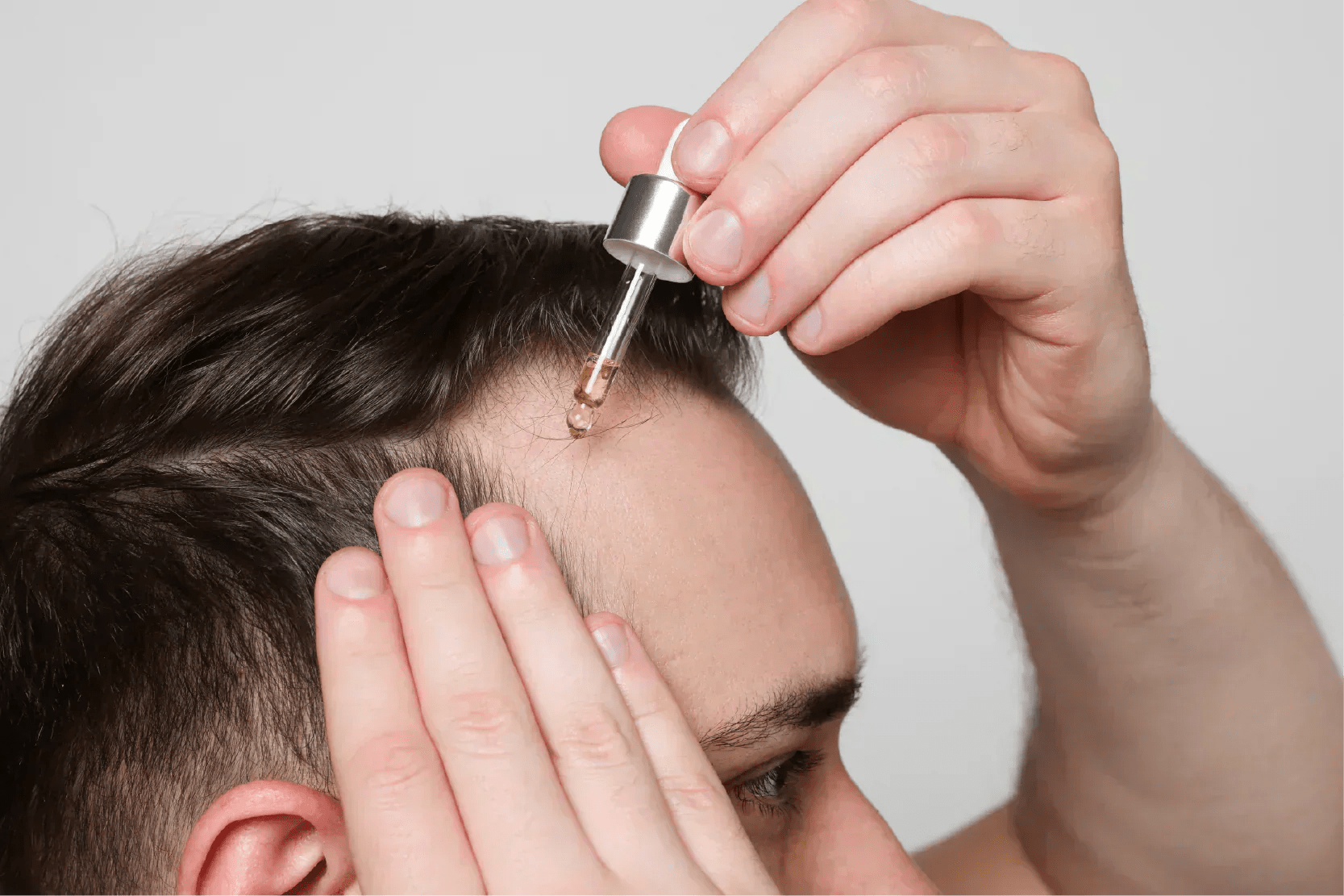 ¿Se pueden usar juntos el minoxidil oral y el tópico? Aquí la verdad que muchos no te dicen - Pharma Grow