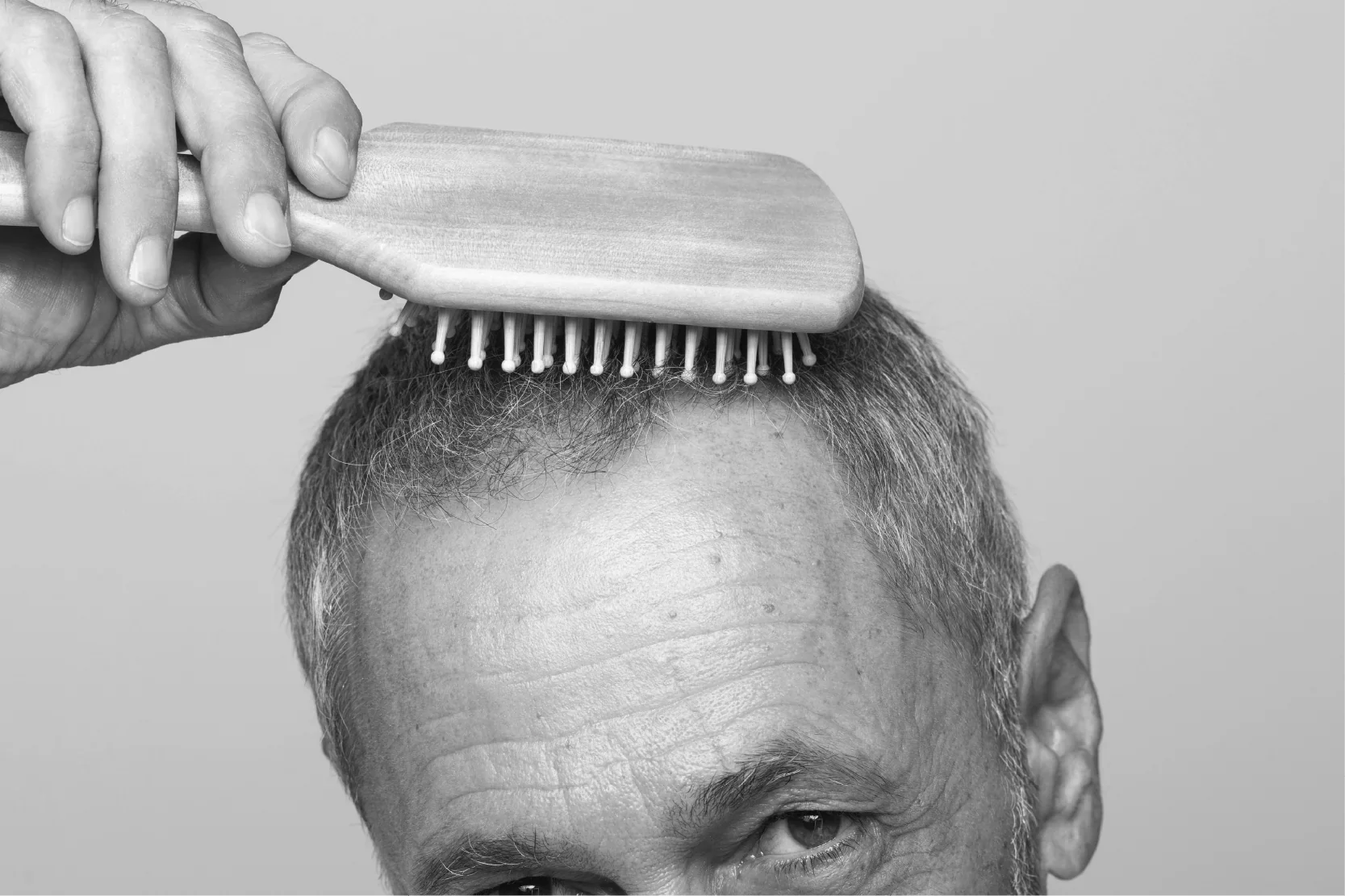 ¿Cuándo verás cambios con Minoxidil? La línea de tiempo real - Pharma Grow