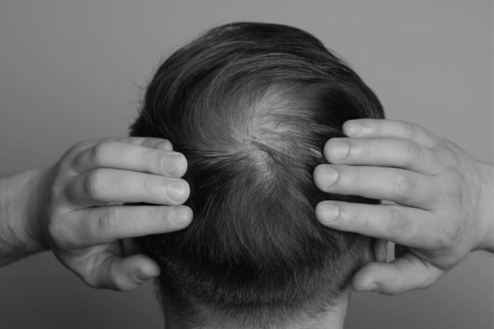 5 causas de caída del cabello y cómo solucionarlo - Pharma Grow