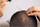 Minoxidil vs Finasteride: ¿Cuál es la diferencia? - Pharma Grow