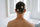 ¿Te apareció una zona redonda sin cabello? Podría ser alopecia areata - Pharma Grow