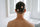 ¿Te apareció una zona redonda sin cabello? Podría ser alopecia areata