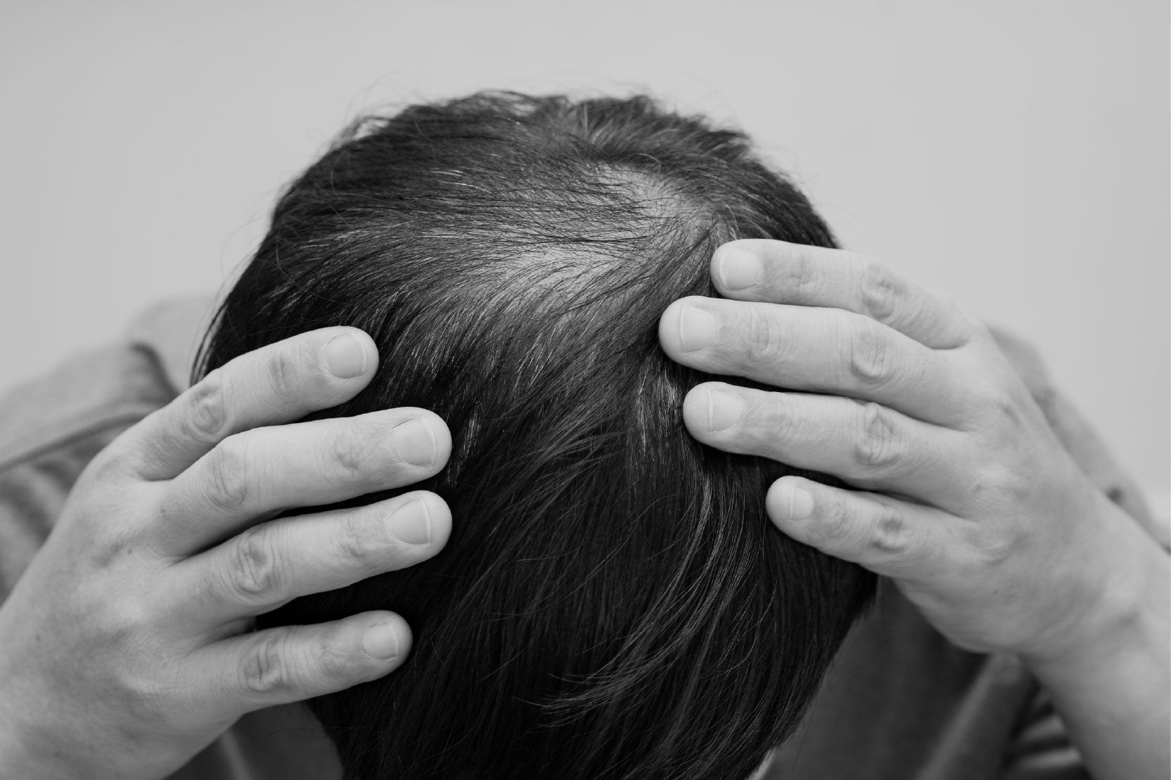 ¿Qué tipo de alopecia tengo? Aprende a identificarla y conoce tu mejor opción - Pharma Grow